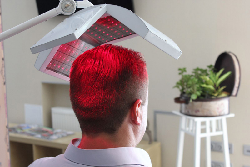 best hair transplant in jaipur jaipur rajasthan