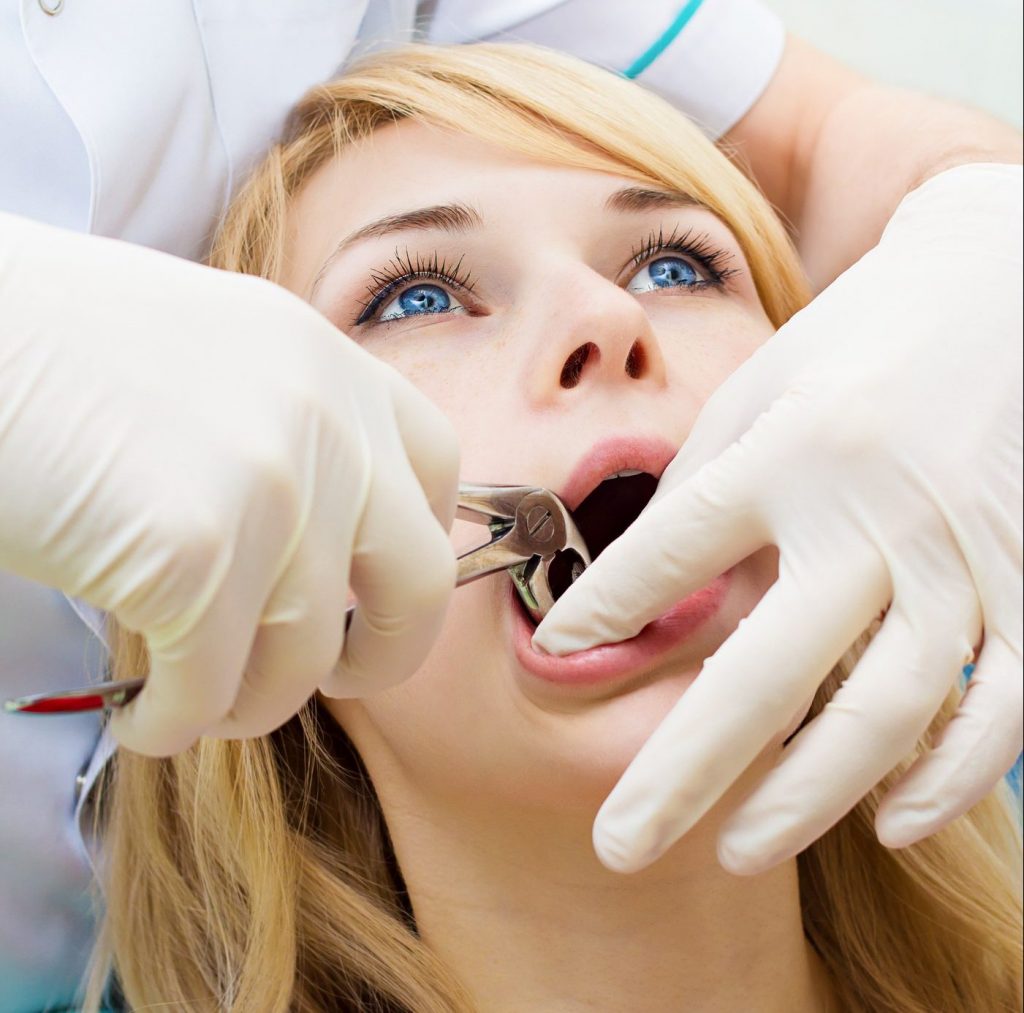 Recovery from Tooth Extraction