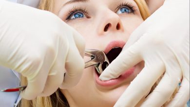 Photo of Tips to Recover Fast from a Tooth Extraction