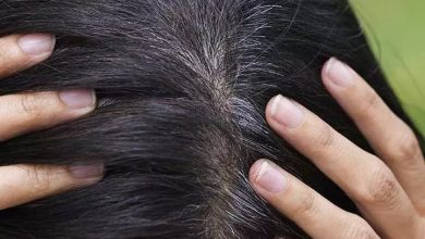 Photo of Premature Grey Hair: Causes and Most Effective Tips to Control Them