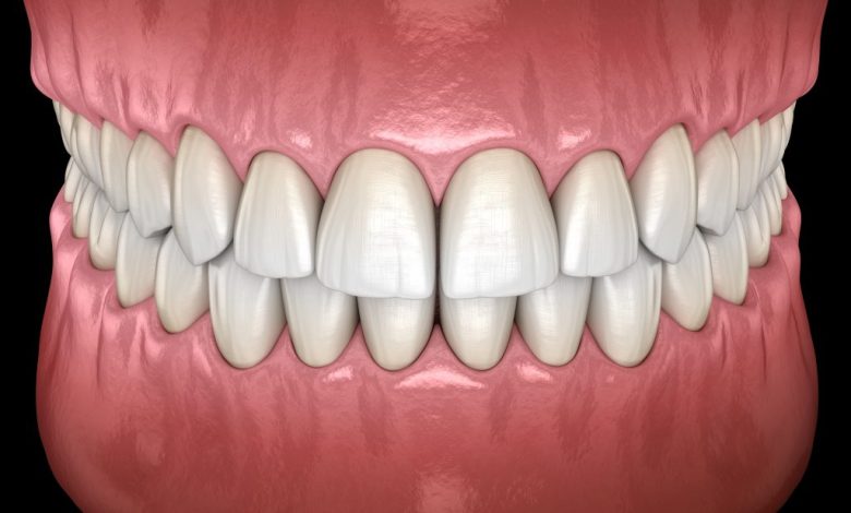 aetna ppo dental