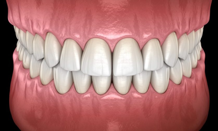 aetna ppo dental