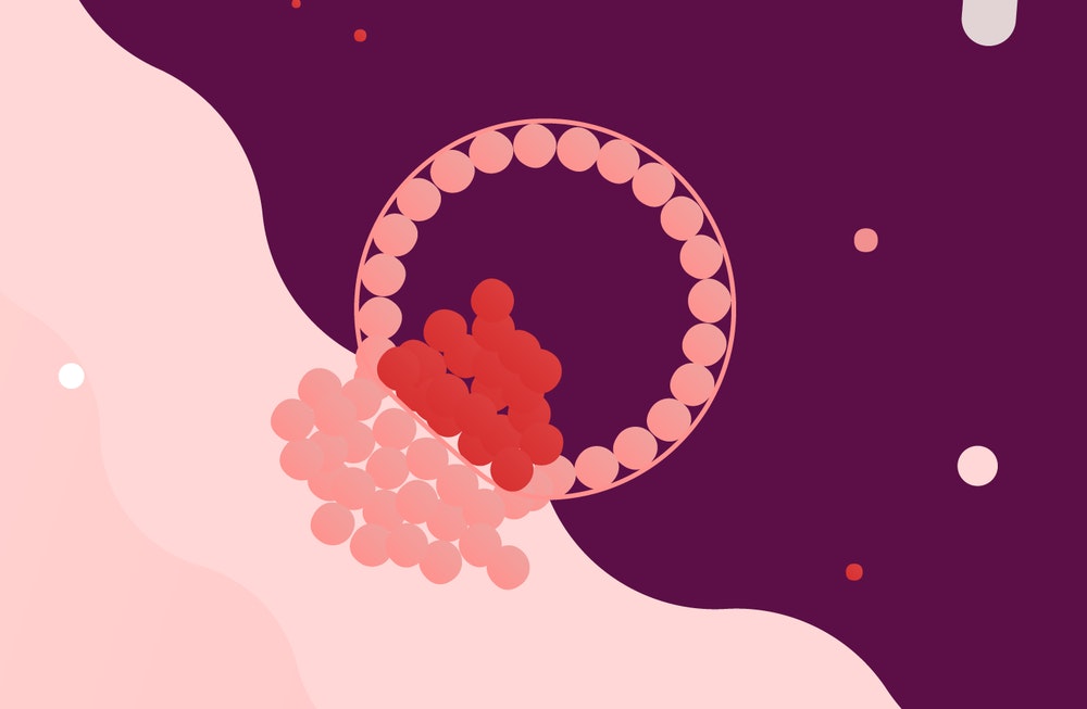 infertility