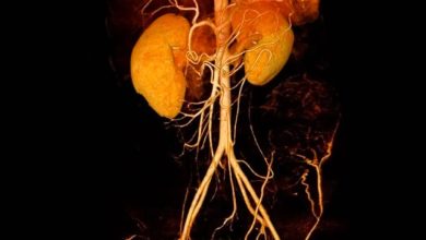 Photo of Understanding Kidney Disease Simply!