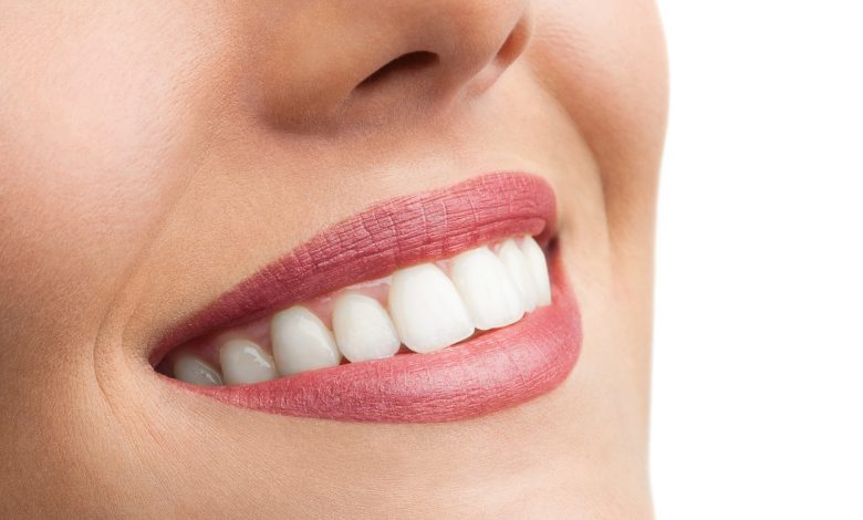 what is major dental care