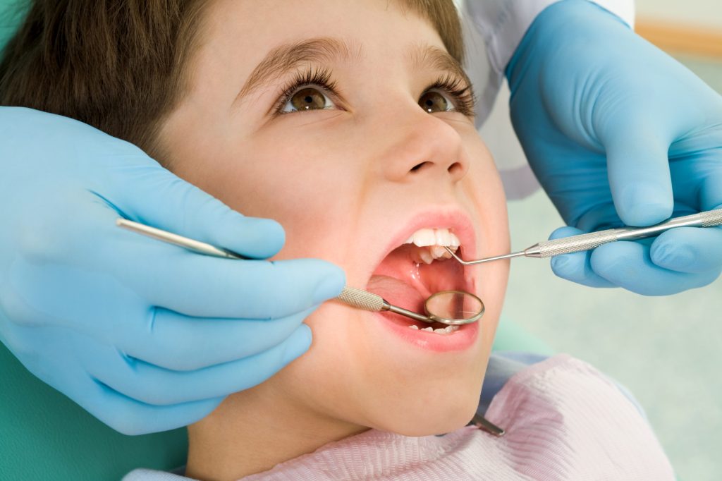early signs of a cavity