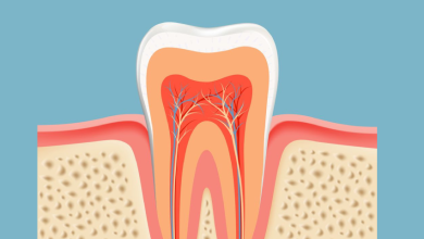 Photo of What Are The Benefits To Root Canal Treatment?