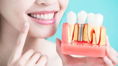 Photo of Reasons Why Dental Implants Are So Popular
